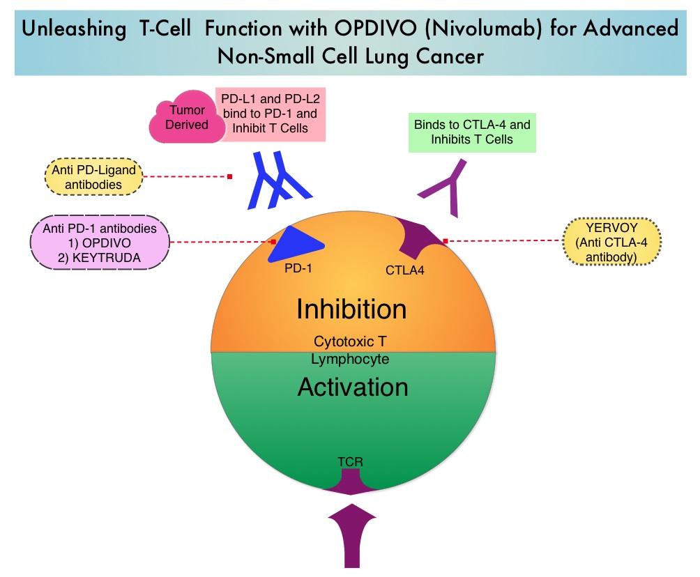 Unleashing-T Cell-Function-with-OPDIVO-for-Advanced-Non-Small-Cell-Lung-Cancer 