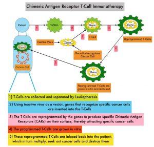 Chimeric-Antigen-Receptor-T-Cell-Immunotherapy